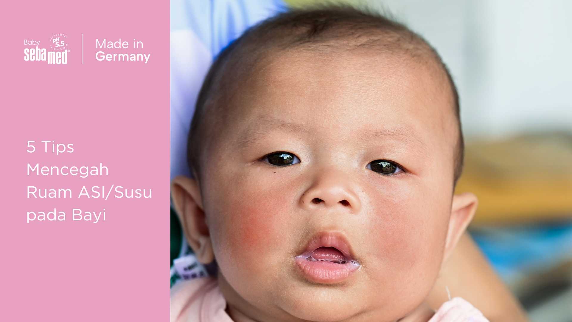 Tips mencegah ruam ASI